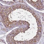 TMEM255B Antibody in Immunohistochemistry (Paraffin) (IHC (P))