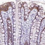 HIGD1A Antibody in Immunohistochemistry (IHC)