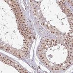 PTPN20A Polyclonal Antibody