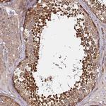 GNL1 Antibody in Immunohistochemistry (Paraffin) (IHC (P))
