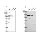 GNL1 Antibody in Western Blot (WB)