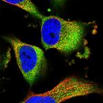 TMEM161A Polyclonal Antibody