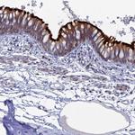 TMEM161A Antibody in Immunohistochemistry (Paraffin) (IHC (P))
