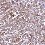 CLIP4 Antibody in Immunohistochemistry (Paraffin) (IHC (P))