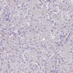 CLIP4 Antibody in Immunohistochemistry (Paraffin) (IHC (P))