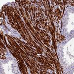 CLIP4 Antibody in Immunohistochemistry (Paraffin) (IHC (P))