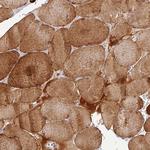 CLIP4 Antibody in Immunohistochemistry (Paraffin) (IHC (P))