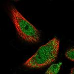 HIC1 Antibody in Immunocytochemistry (ICC/IF)