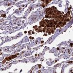 HIC1 Antibody in Immunohistochemistry (Paraffin) (IHC (P))