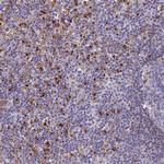 HIC1 Antibody in Immunohistochemistry (Paraffin) (IHC (P))