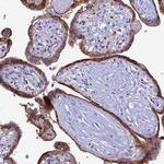 HIC1 Antibody in Immunohistochemistry (Paraffin) (IHC (P))