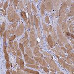 HIC1 Antibody in Immunohistochemistry (Paraffin) (IHC (P))
