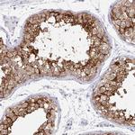 Doppel Antibody in Immunohistochemistry (IHC)