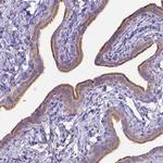 C4orf22 Antibody in Immunohistochemistry (Paraffin) (IHC (P))