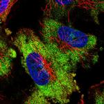 ATXN2L Polyclonal Antibody