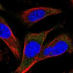 MARCH3 Polyclonal Antibody