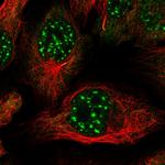 ZNF584 Polyclonal Antibody