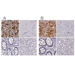PNMT Polyclonal Antibody