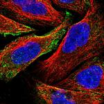 C19orf60 Polyclonal Antibody