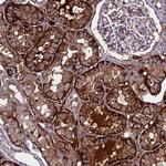 C19orf60 Antibody in Immunohistochemistry (Paraffin) (IHC (P))