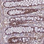 PABPN1L Polyclonal Antibody