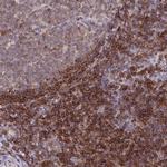 RASAL3 Polyclonal Antibody