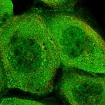 PHLB3 Polyclonal Antibody