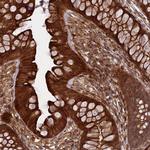 PHLB3 Antibody in Immunohistochemistry (Paraffin) (IHC (P))