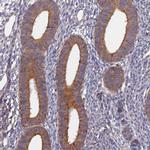 SLC38A11 Polyclonal Antibody