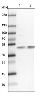 KRR1 Antibody in Western Blot (WB)
