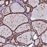 C5orf30 Antibody in Immunohistochemistry (Paraffin) (IHC (P))