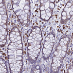 C5orf30 Antibody in Immunohistochemistry (Paraffin) (IHC (P))