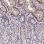 C4orf19 Antibody in Immunohistochemistry (IHC)