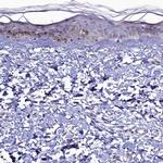 C4orf19 Antibody in Immunohistochemistry (IHC)