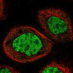 NOSIP Polyclonal Antibody