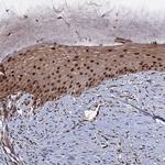 NOSIP Antibody in Immunohistochemistry (Paraffin) (IHC (P))