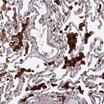 NOSIP Antibody in Immunohistochemistry (Paraffin) (IHC (P))