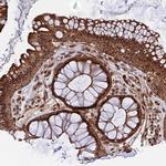 NOSIP Antibody in Immunohistochemistry (Paraffin) (IHC (P))