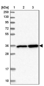LZTFL1 Antibody in Western Blot (WB)
