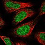 CCDC174 Polyclonal Antibody