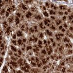 CCDC174 Antibody in Immunohistochemistry (Paraffin) (IHC (P))
