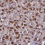 PLAC9 Polyclonal Antibody