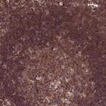 KIAA0922 Antibody in Immunohistochemistry (IHC)
