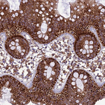 MRPS9 Antibody in Immunohistochemistry (Paraffin) (IHC (P))