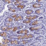 KDELR3 Antibody in Immunohistochemistry (Paraffin) (IHC (P))