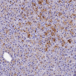 KDELR3 Polyclonal Antibody