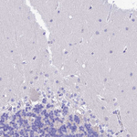 KDELR3 Antibody in Immunohistochemistry (Paraffin) (IHC (P))
