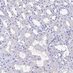 KDELR3 Antibody in Immunohistochemistry (Paraffin) (IHC (P))