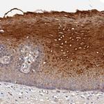 MRPL35 Polyclonal Antibody