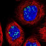 RSL1D1 Polyclonal Antibody